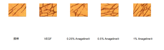 角化症用的绿色管状药膏