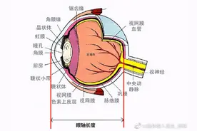 你对眼轴与其增长的问题都有哪些误解？图片
