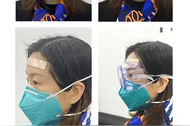 这项科研成果让一线医护人员告别勒痕图片