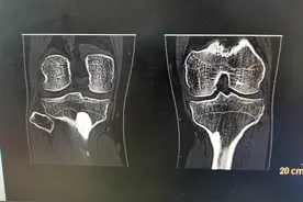 猜猜是个什么图片