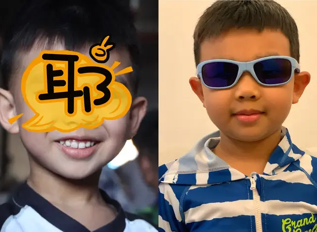 肠胃炎可以吃花胶吗 肠胃炎可不可以吃花甲