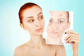 这三种祛痘印产品别乱用，当心脸更烂了图片