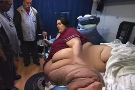 世界上最肥的男人，肥胖程度令人发指图片