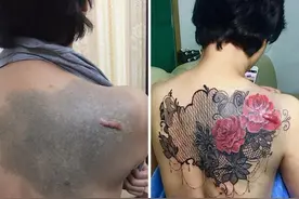 为了掩盖那些难看的伤疤，纹身师们个个脑洞大开图片