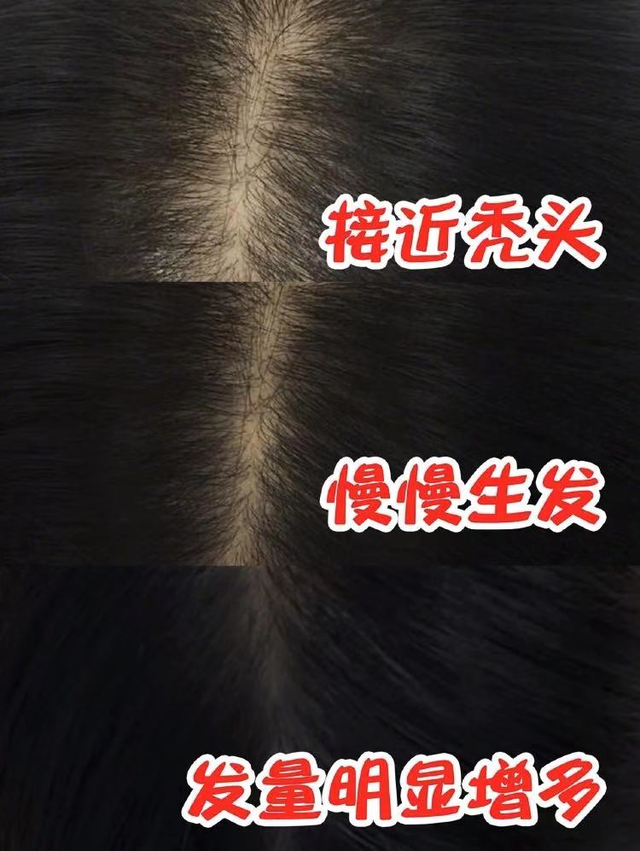 80后最爱的洗发水！“蜂花”再现江湖，上线3天就卖出了80000瓶