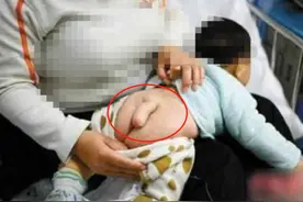 1岁男孩长出“小尾巴”，送医检查后，婆婆怒骂儿媳：你这丧门星图片