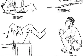 如何早期发现大肠癌？图片