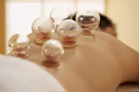 拔火罐时，后背出来的瘀血，是排出的毒素吗？大多数人还不了解图片