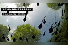 为治牙痛，五旬阿姨每天生吃小蝌蚪！一查发现感染寄生虫，病灶遍布各个器官图片