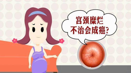 宫颈糜烂有什么症状和现象(产后宫颈糜烂有什么症状和现象)-直商汇