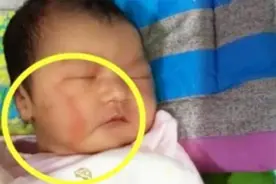 “医生，别给我用产钳”，产妇难产要求跪姿分娩，顺利躲过产钳术图片