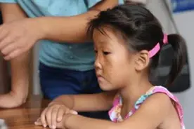 还记得“面具女孩”？因父母无知毁了一张脸，网友：这常识都不懂图片