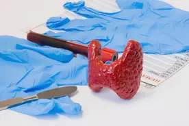 甲状腺结节不宜吃豆腐？保护甲功，这3种食物或需“挥泪告别”图片
