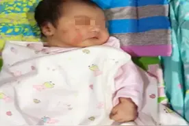 宝宝健不健康，其实头发就是“风向标”，若有这些特征，可能遭罪图片