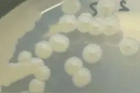 炭疽细菌的前世今生：从发现到成为生物攻击武器及恐怖袭击案例图片