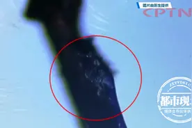 女子眼睛干痒痛，元凶竟是螨虫，长在睫毛根上图片