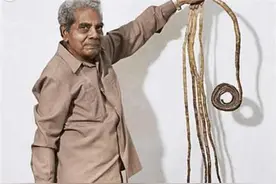 大爷66年没剪指甲，将9米长指甲捐给博物馆后”手指有了新的变化图片