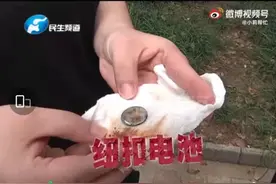 1岁男童误吞电池导致食管被腐蚀！如何避免孩子误食家庭用品？图片