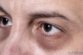 由于肾的不合作，极有可能影响你的六大状况图片