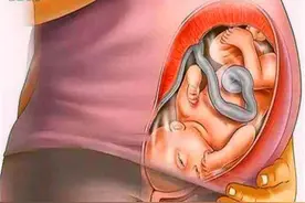 孕晚期，胎宝宝头朝下晕眩难受吗？为了见妈妈，胎儿其实很努力图片