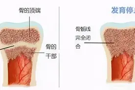 儿科医生：到了这年龄，男孩基本已经“截止长高”，家长别错过图片