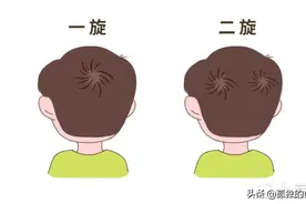 头上2个“旋儿”的宝宝更聪明？科学是这样解释的图片