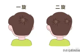 头上2个“旋儿”的宝宝更聪明？科学是这样解释的图片