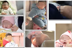 激素面霜造成大脸娃娃，你以为这就完事儿了？图片