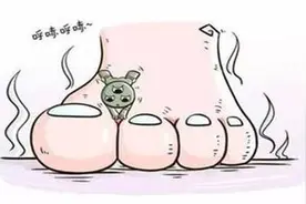 脚气是什么？我们得了脚气应该怎么办？图片
