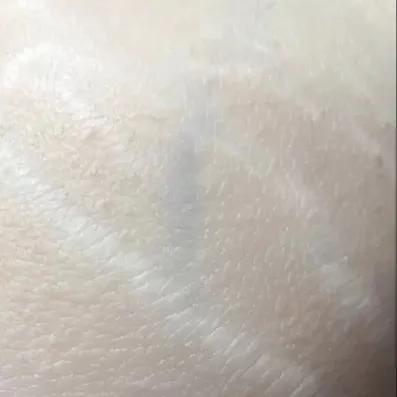 野脚鸡皮肤穿裙子 野脚鸡皮肤穿裙子