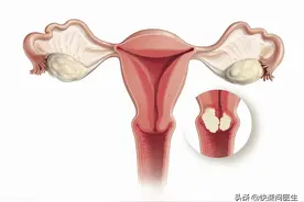 子宫也是有寿命的，四个行为最伤子宫，希望你一个都没有图片