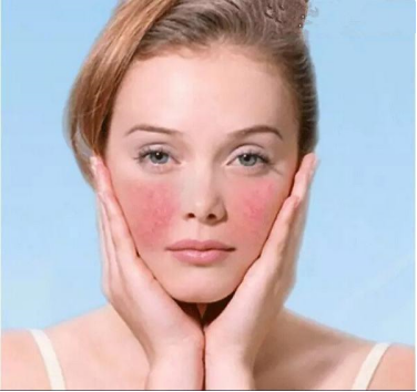 夏日“绝绝子”，一支修护乳竟有如此功效