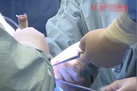 被疼痛折磨一年，女子一连拔除3颗大牙！医生：你全部都白拔了图片