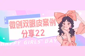 微创双眼皮案例分享25图片