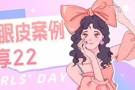 微创双眼皮案例分享25图片