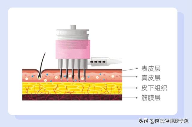 銆岃彶娲涘槈銆嶈繕鑳戒笉鑳芥墦锛熷浗鍐呭凡缁忔湁浜嗐€屽悎娉曟浛浠ｅ搧銆? onerror=