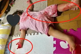 妈妈出门买菜，回家发现女儿倒在"血泊"中，大哭时孩子突然坐起图片
