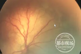 宝宝眼睛反光还“发亮”？医院一查，事情大不妙！图片