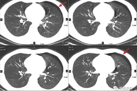 快收藏，CT诊断报告模板大全图片