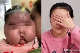 女宝宝一个月胖3斤，全身长汗毛！医生：当心这款黑心的宝宝霜图片