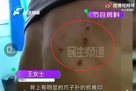 河南“狗咬老人”事件后续：王新刚被撤职，相关责任人被处分图片
