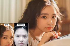 澳大利亚留学生，本拥有老天“赏饭吃”的眼睛，割双眼皮后全毁了图片