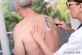 警惕！银屑病易反复、预后差，春季正值高发期！专家提醒，这4点要做好预防图片