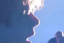 明星整容后患也无穷：猪鼻子是硅胶挛缩，胖脸可能是整容消肿期图片