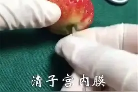 “人流”对女性的伤害有多大？看了这颗草莓，以后对女朋友好点图片