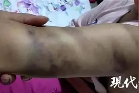 作业未完成，小学生被打得浑身淤青！淮安一涉事老师被停职图片