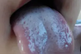 舌头这个健康的显示器一定要懂，因为可以随时看清身体内部的异常图片