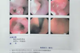 爱吃“烫食”，58岁大爷烫出食管癌图片