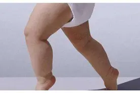 总怕孩子长不高？别急，娃腿部有这2特征，是个头“高挑”的征兆图片