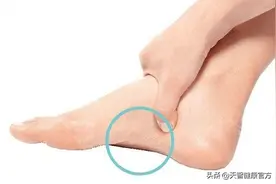 扁平足为什么不能参军？了解它的危害之后，你就知道了图片